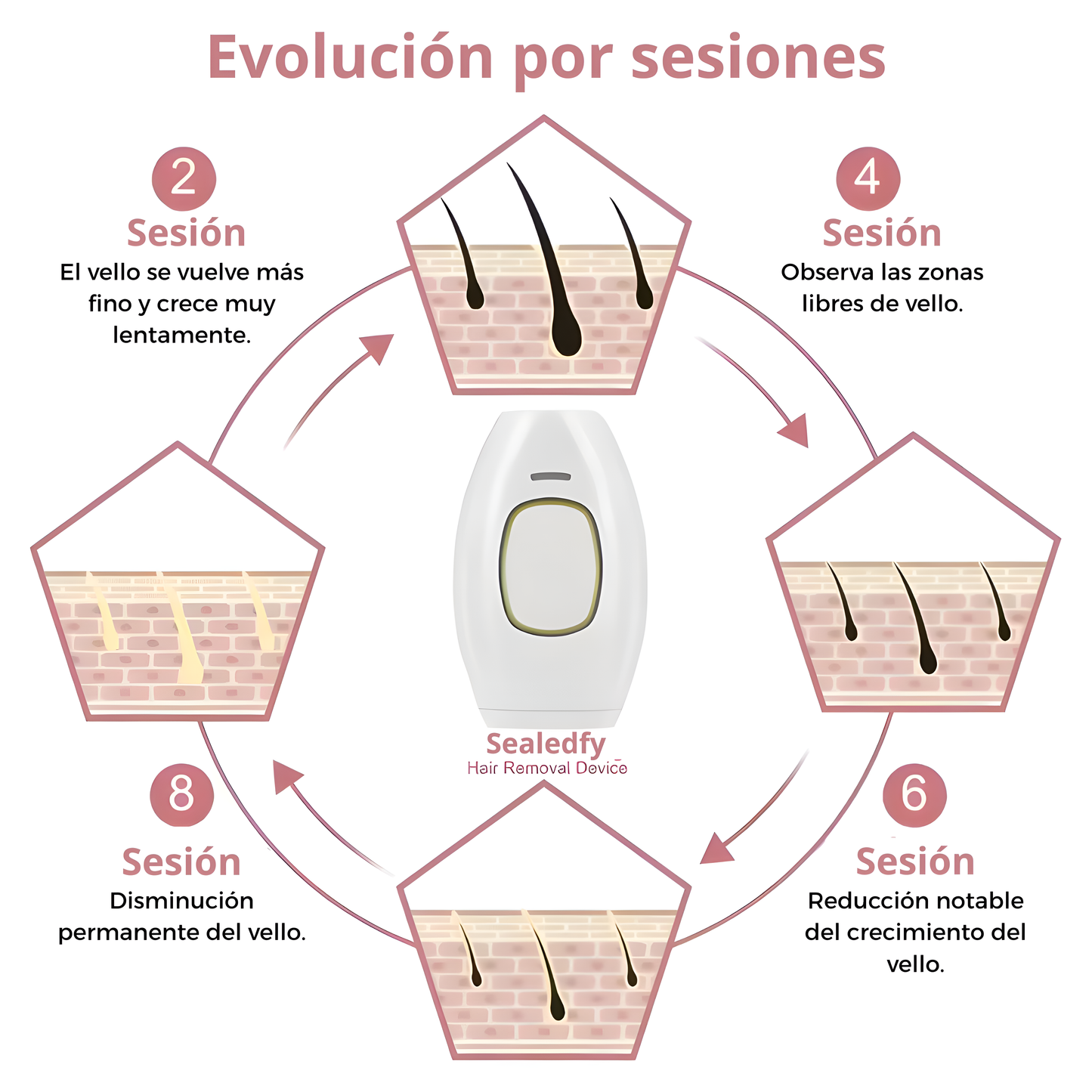 DEPILADORA LÁSER-IPL